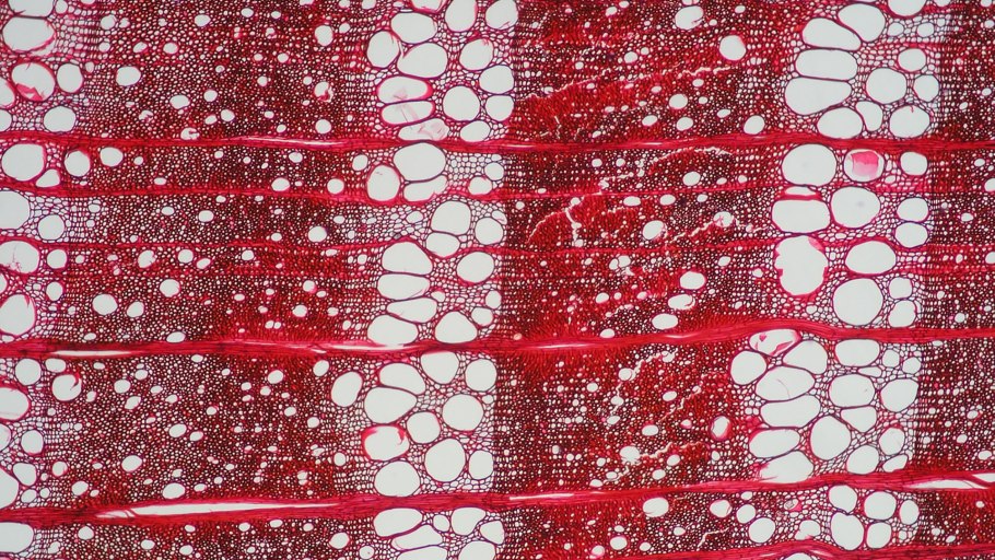 Xylem 835857