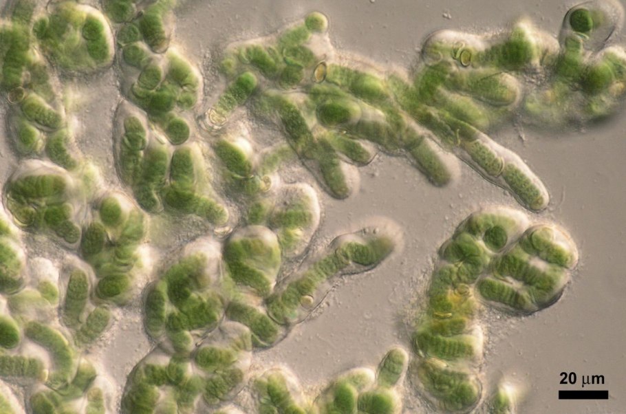 Нитчатая водоросль Ульва