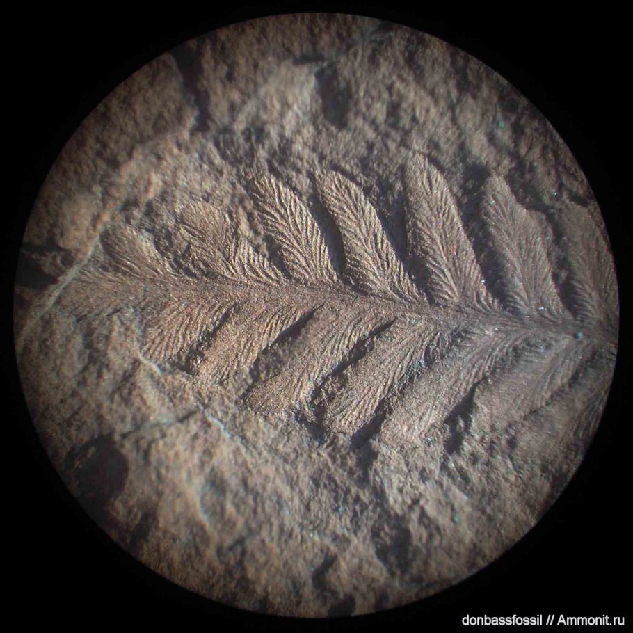 Медуллоза Ноэ