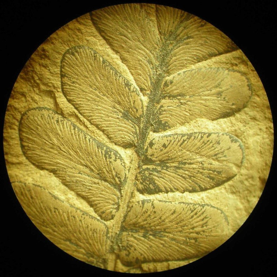 Медуллоза Ноэ