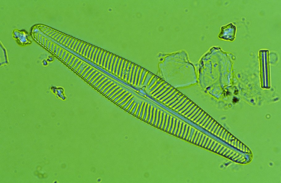 Algae Xanthophyta