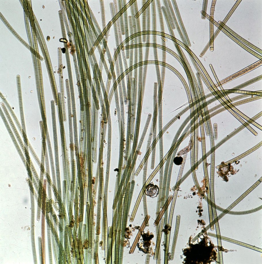 Водоросль micrasterias