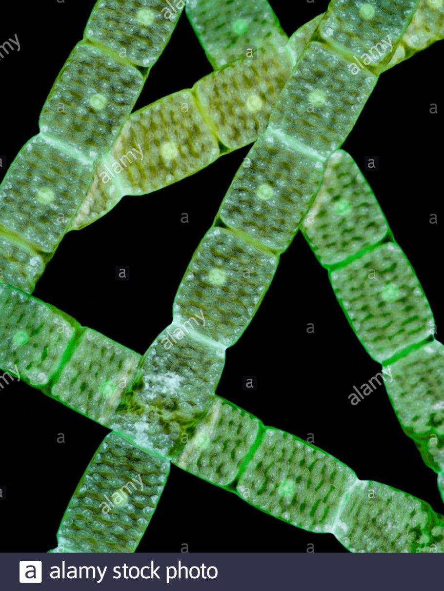 Инфузория Бурсария