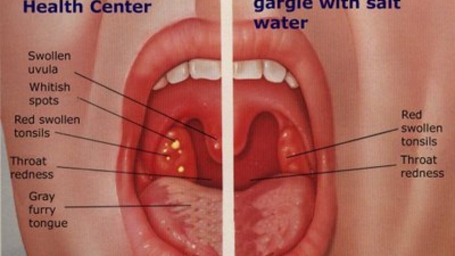 Щитовка и ложнощитовка