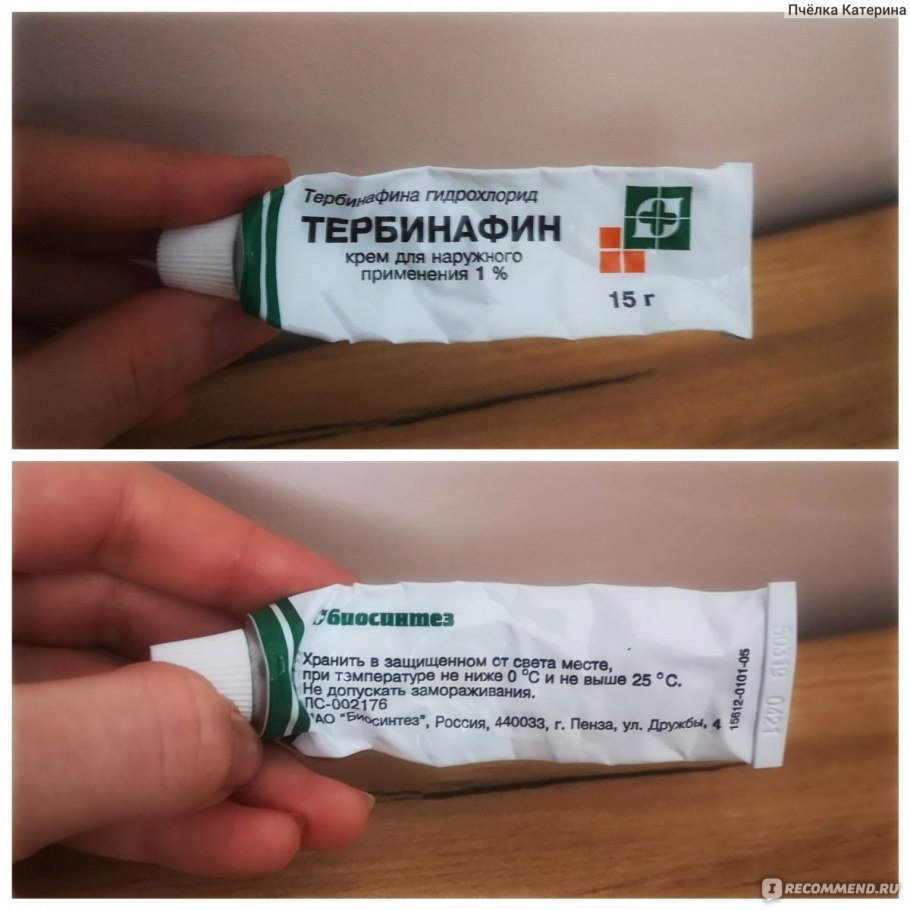 Холинергическая крапивница