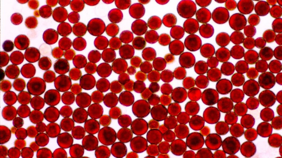 Astaxanthin Haematococcus Pluvialis