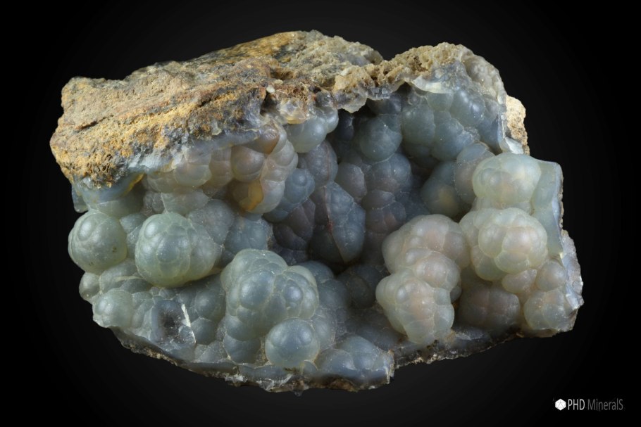 Камень в нижней трети мочеточника рентген