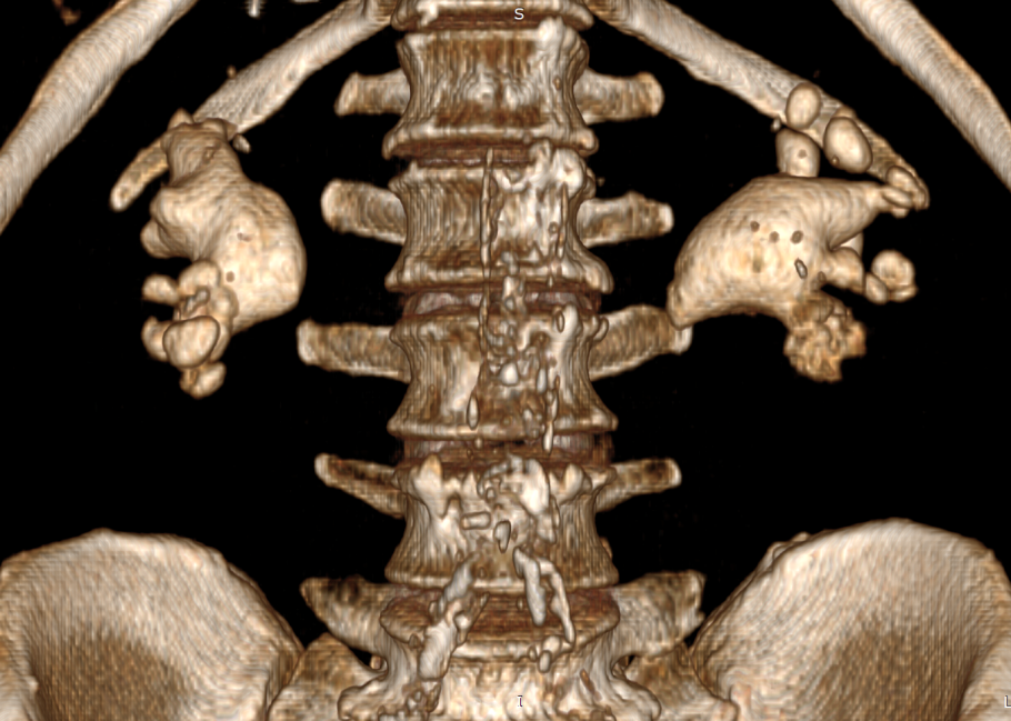 Ежовик коралловидный-гериций.