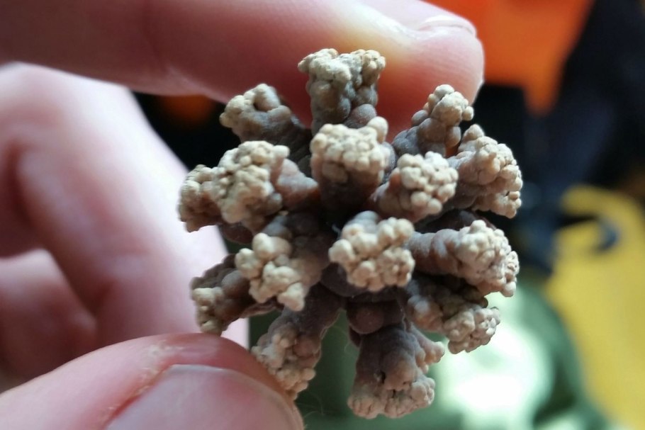 Обзорная урография мочекаменная болезнь