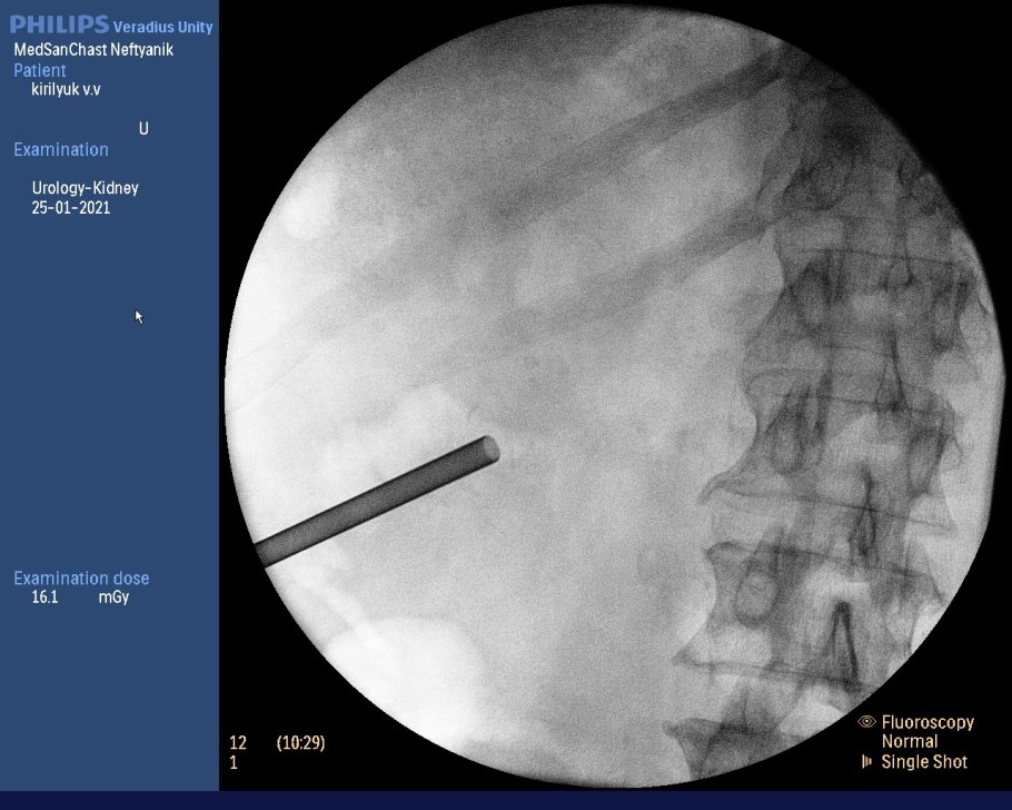 Агат, Оникс, опал, турмалин, хризопраз