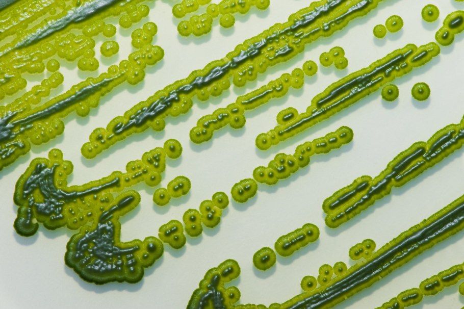 Разнонитчатая структура водорослей