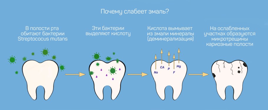 Чувствительная эмаль зубов