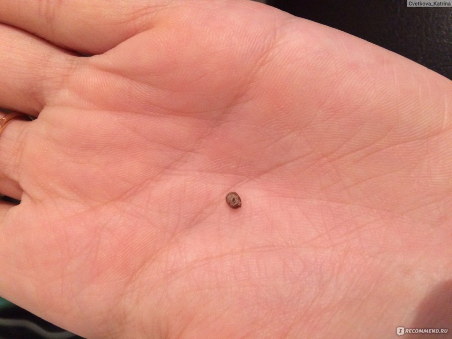 Контогеозныймоллюск на коже