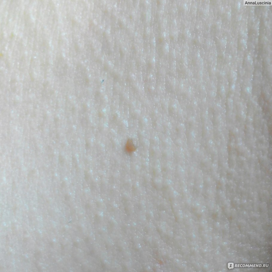 Фиброэпителиальный невус