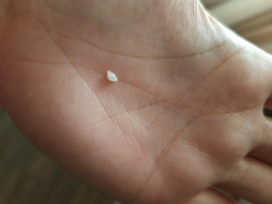 Лентигиозная меланома