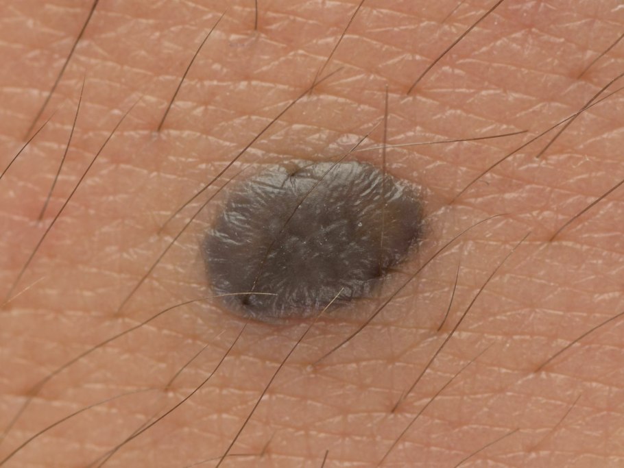 Нитчатые зеленые водоросли