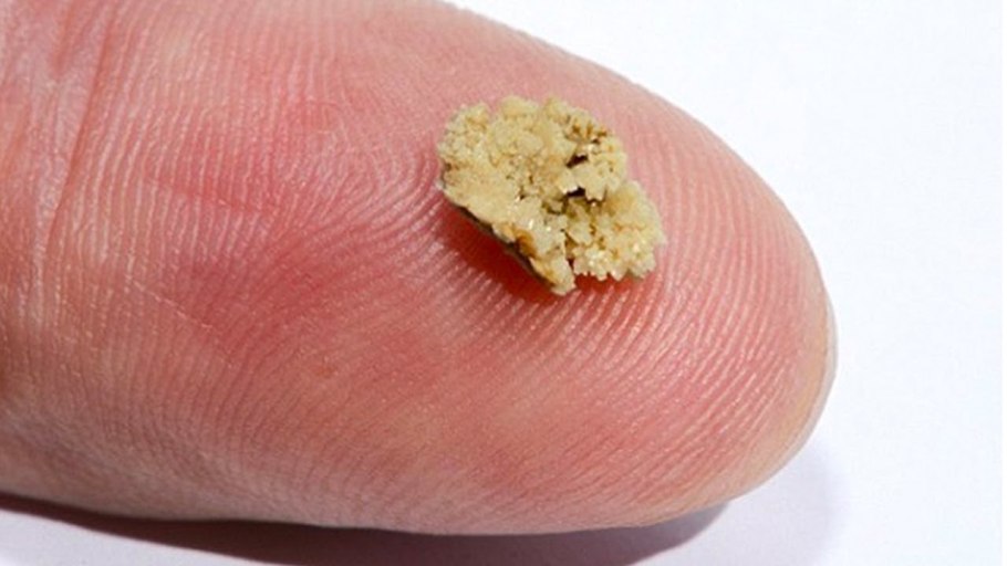 Пластырь для сухих мозолей Салипод