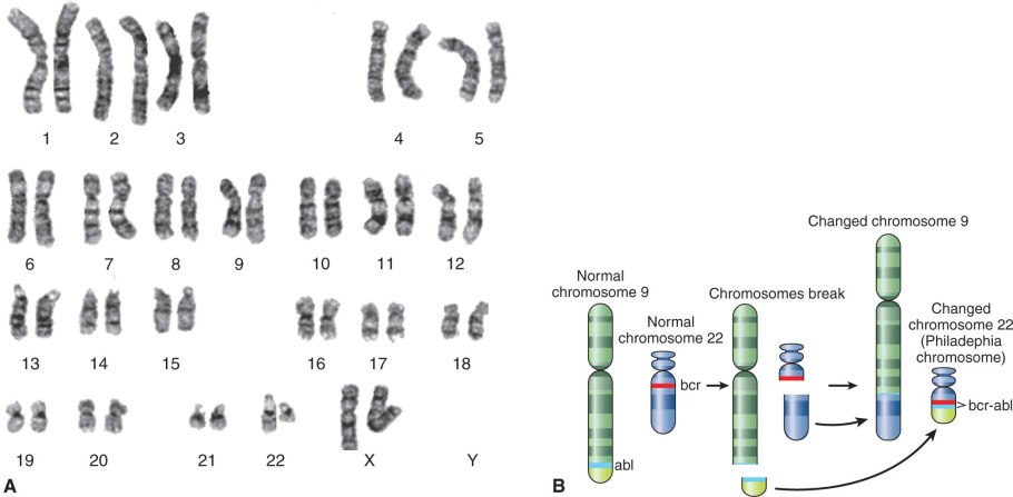 Филадельфийская хромосома