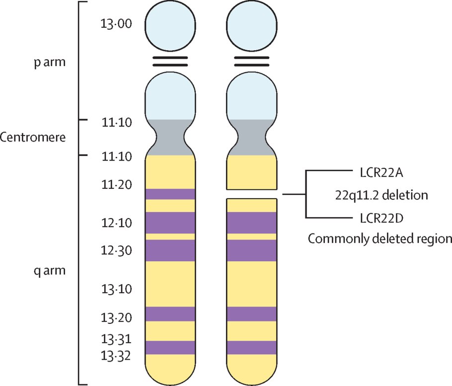 Q11.2 хромосома