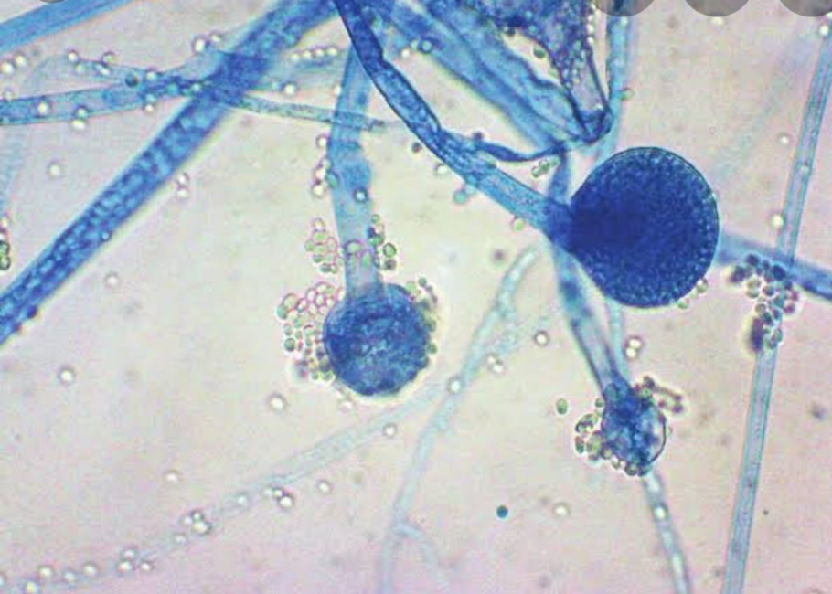 Rhizopus Niveus