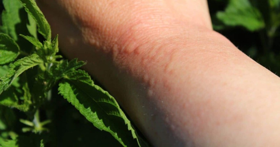 World stinging Nettle eating Championship.