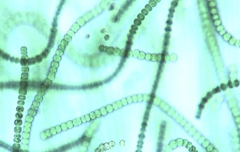 Зелёные водоросли Эстетика