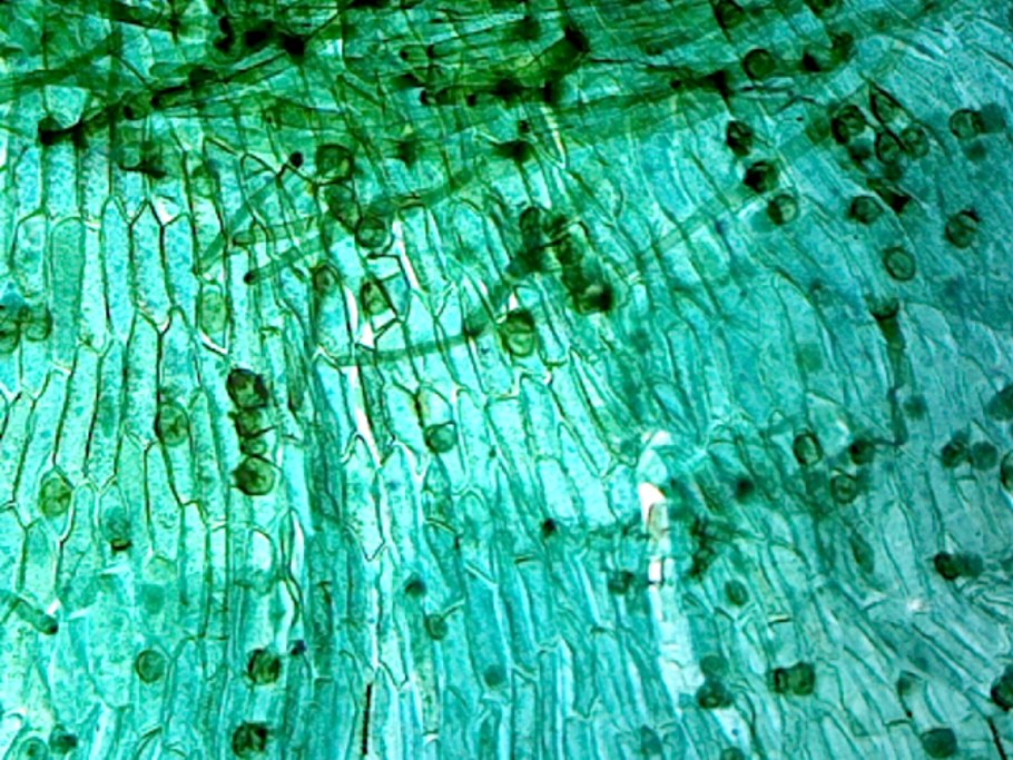 Таллом лишайника под микроскопом