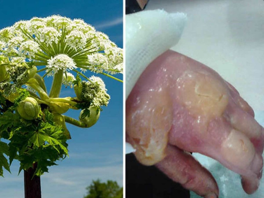 Семена борщевика Сосновского