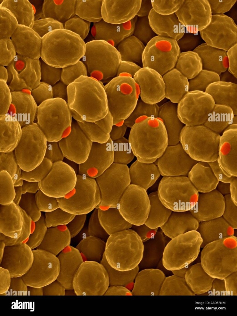 Дрожжей Saccharomyces cerevisiae микроскопия