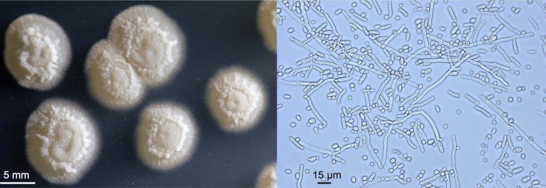 Оидиум Лактис под микроскопом