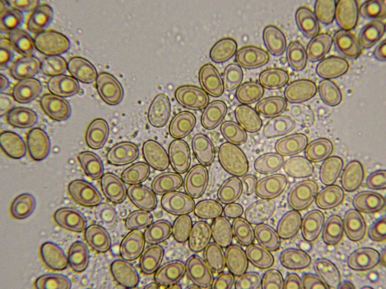 Клетки мицелия гриба под микроскопом