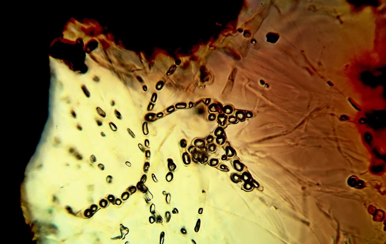 Микроскопия паразитарные грибы