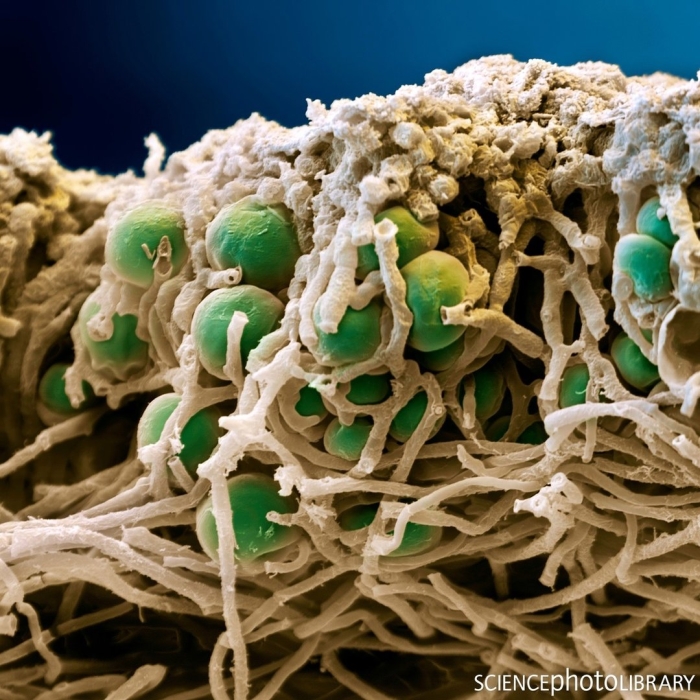 Лишайник микрофотография