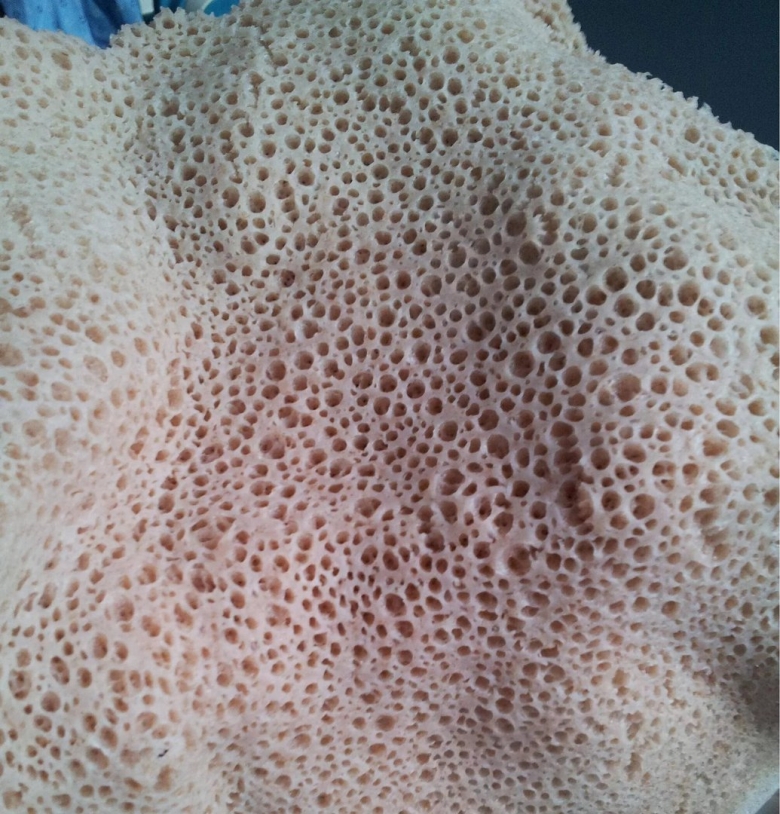 Песчаная блоха трипофобия