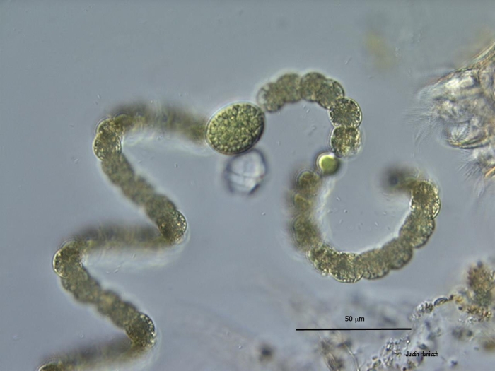 Цианобактерия анабена