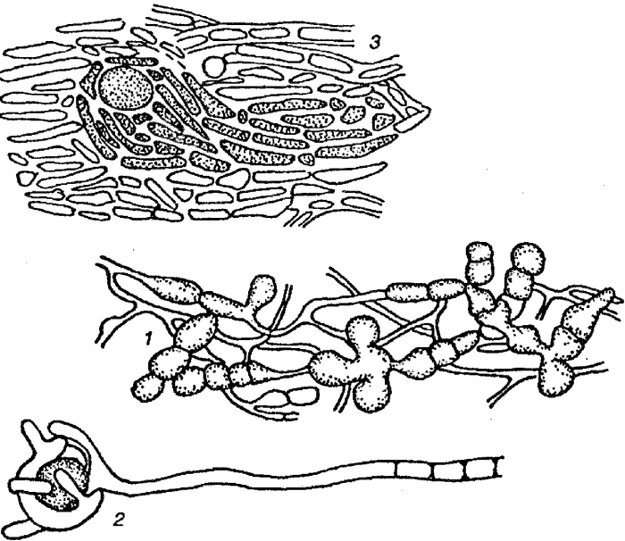 Гаустории лишайника