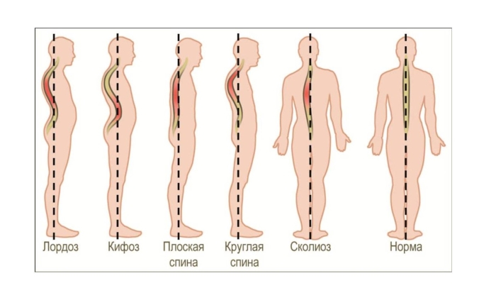 Позвоночник человека лордоз кифоз