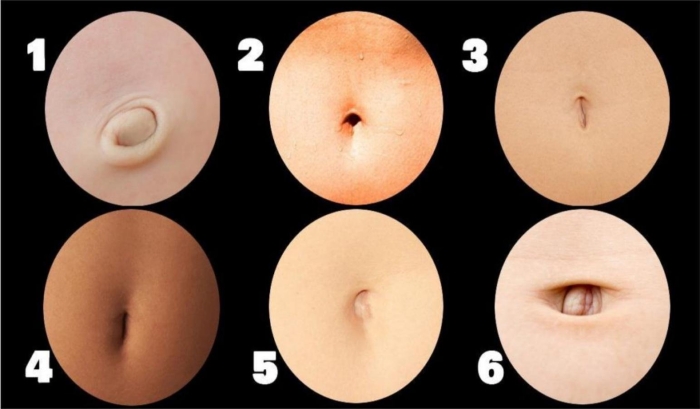 От чего зависит форма пупка