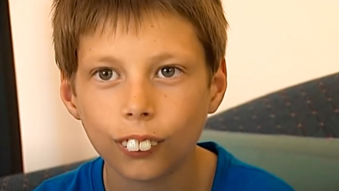 Люди с большими передними зубами