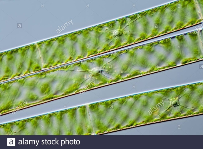Spirogyra sp