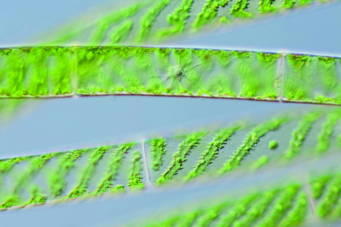Спирогира под микроскопом
