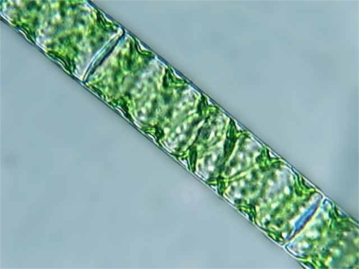 Spirogyra lagercheimii