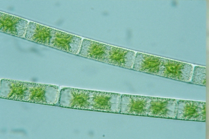 Спирогира под микроскопом