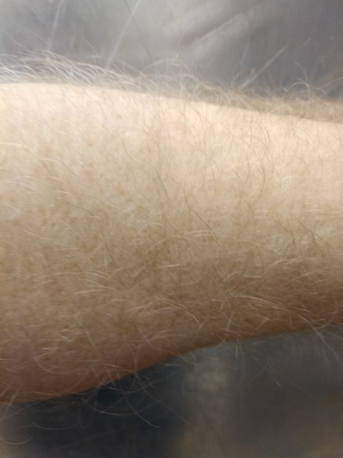Волосы на руках