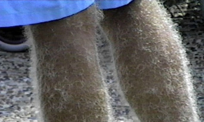 Нога волосатая